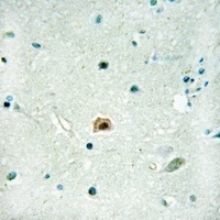 SOX8 Rabbit Polyclonal Antibody