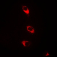 CaMK2 beta Rabbit Polyclonal Antibody