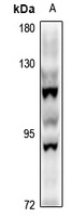 STON1 Rabbit Polyclonal Antibody