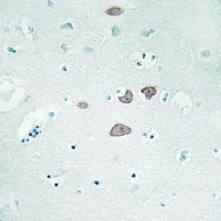 STON1 Rabbit Polyclonal Antibody
