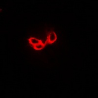 STON1 Rabbit Polyclonal Antibody