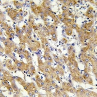 Cytochrome P450 2C8/9/18/19 Rabbit Polyclonal Antibody
