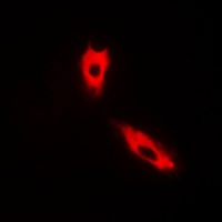 Cytochrome P450 2C8/9/18/19 Rabbit Polyclonal Antibody