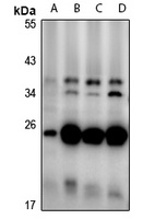 CD160 Rabbit Polyclonal Antibody