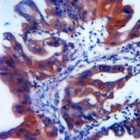 ATG5 Rabbit Polyclonal Antibody