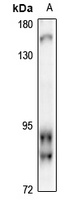 RFX2 Rabbit Polyclonal Antibody