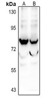 SIX5 Rabbit Polyclonal Antibody