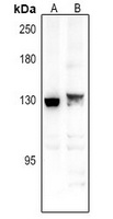 Spinophilin Rabbit Polyclonal Antibody