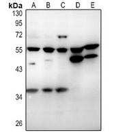 CD215 Rabbit Polyclonal Antibody