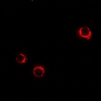 5-HT5A Rabbit Polyclonal Antibody