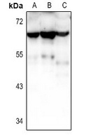 CRHR2 Rabbit Polyclonal Antibody