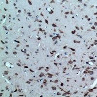 CRHR2 Rabbit Polyclonal Antibody