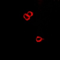 CRHR2 Rabbit Polyclonal Antibody