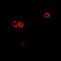 CHRM4 Rabbit Polyclonal Antibody