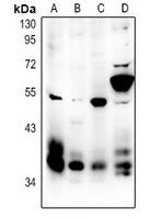 MCH Receptor 1 Rabbit Polyclonal Antibody