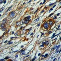 MCH Receptor 1 Rabbit Polyclonal Antibody