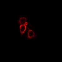 MCH Receptor 1 Rabbit Polyclonal Antibody