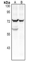 CD125 Rabbit Polyclonal Antibody