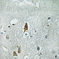 CD125 Rabbit Polyclonal Antibody