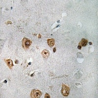 NCOA3 Rabbit Polyclonal Antibody