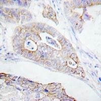 CD45 Rabbit Polyclonal Antibody