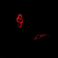 CD45 Rabbit Polyclonal Antibody