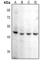CD142 Rabbit Polyclonal Antibody