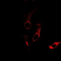 Laminin alpha 3 Rabbit Polyclonal Antibody