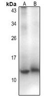 CCL18 Rabbit Polyclonal Antibody