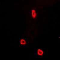 SCN7A Rabbit Polyclonal Antibody