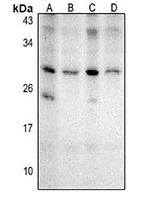 NKX2-8 Rabbit Polyclonal Antibody