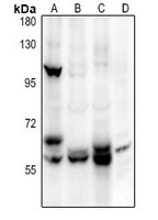 ALPL Rabbit Polyclonal Antibody