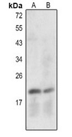 Caspase 7 p20 Rabbit Polyclonal Antibody