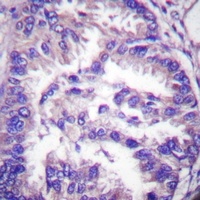 Caspase 7 p20 Rabbit Polyclonal Antibody