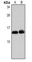 CCL2 Rabbit Polyclonal Antibody