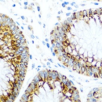 CCL2 Rabbit Polyclonal Antibody