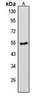 Desmin Rabbit Polyclonal Antibody