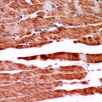 Desmin Rabbit Polyclonal Antibody