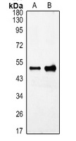 GFAP Rabbit Polyclonal Antibody