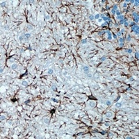GFAP Rabbit Polyclonal Antibody
