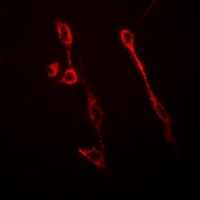 GFAP Rabbit Polyclonal Antibody
