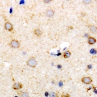 IL-22 Rabbit Polyclonal Antibody