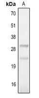 IL-25 Rabbit Polyclonal Antibody