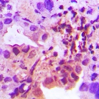 IL-25 Rabbit Polyclonal Antibody