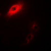 IL-25 Rabbit Polyclonal Antibody