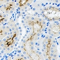 CD34 Rabbit Polyclonal Antibody