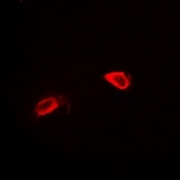 CD34 Rabbit Polyclonal Antibody