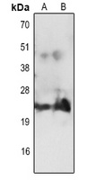 CD3e Rabbit Polyclonal Antibody