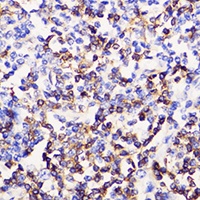 CD3e Rabbit Polyclonal Antibody