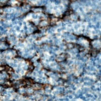 IL-6 Rabbit Polyclonal Antibody